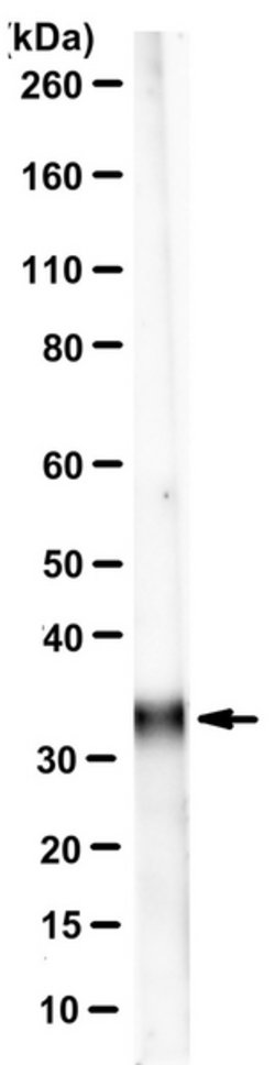 Ketohexokinase Isoform C, Mouse anti-Human, Clone: 5F1-3F5, Millipore Sigma:Antibodies:Primary
